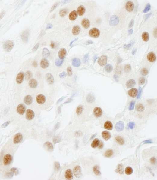 Polyclonal Rabbit anti-Human GTF3C5 Antibody (aa469-519, IHC)