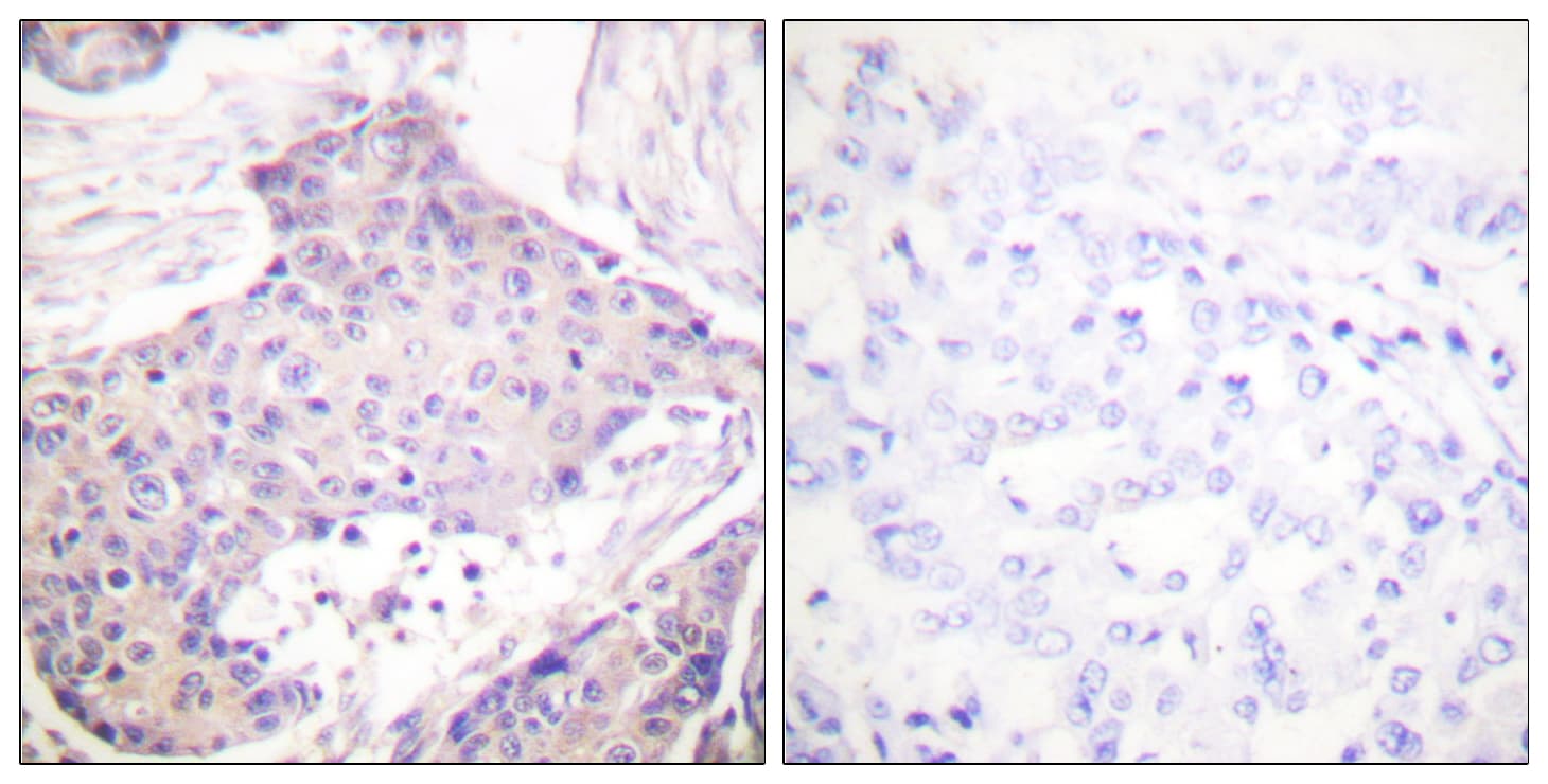 Polyclonal Rabbit anti-Human CARD6 Antibody (aa1-50, IHC, IF, WB)