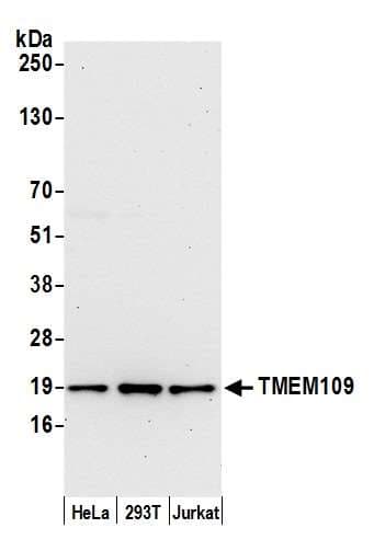 Polyclonal Rabbit anti-Human TMEM109 Antibody (aa25-75, WB)