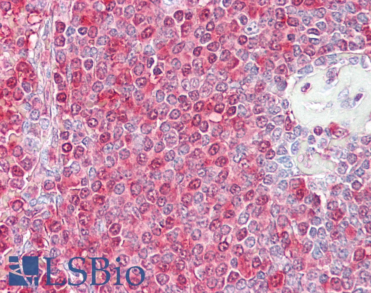 PathPlus™ Polyclonal Rabbit anti-Human MTOR Antibody (aa2415-2464, IHC, WB)