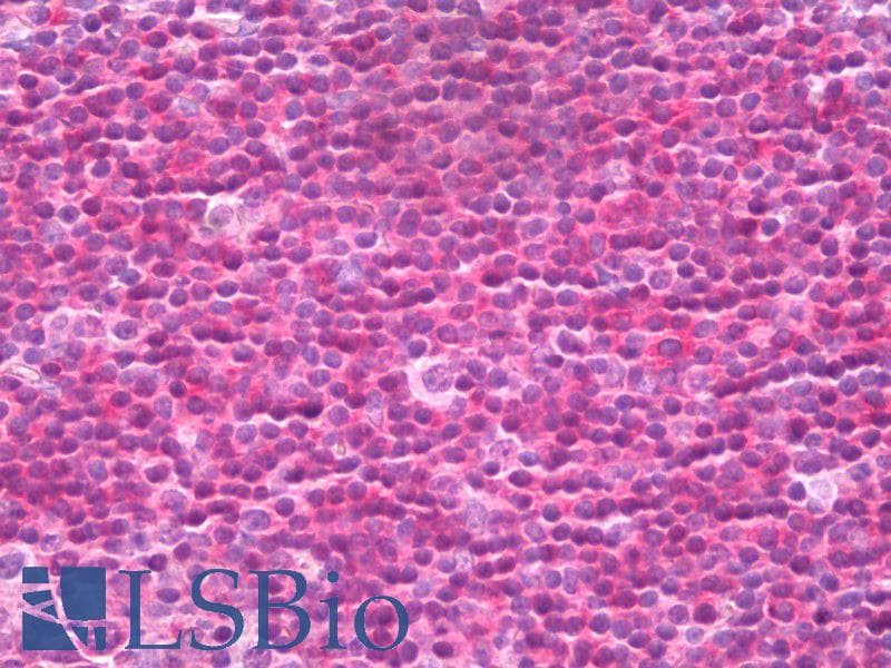 IHC-plus™ FOXO1 / FKHR Antibody (aa295-344)