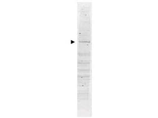IHC-plus™ POLK / DNA Polymerase Kappa Antibody