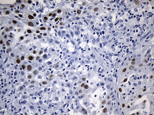 ELF3 / ESE1 Antibody (aa175-286, clone OTI2G6, Carrier-free)