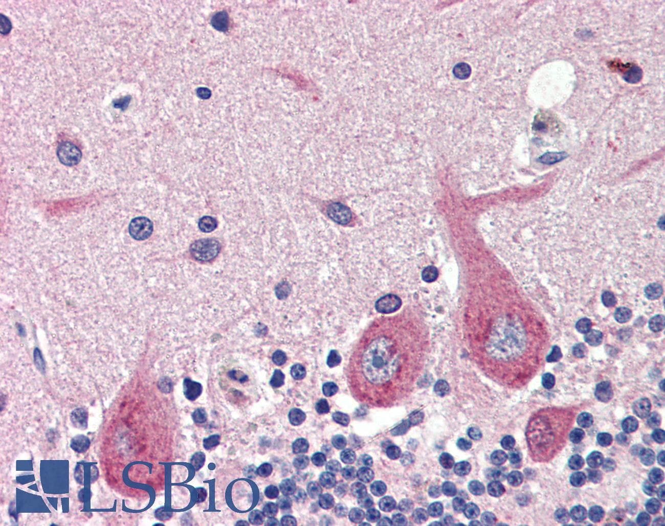 PathPlus™ GAD1 / GAD67 Antibody (aa526-537)