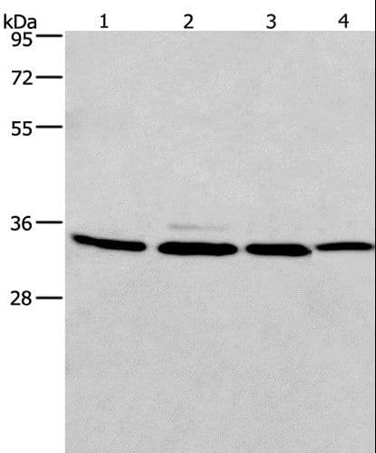 CMT2 / MAD2L1BP Antibody