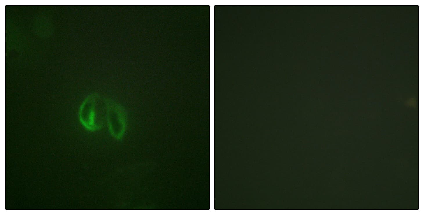 IL10RA Antibody (aa462-511)
