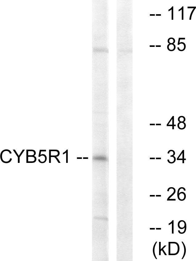 CYB5R1 Antibody