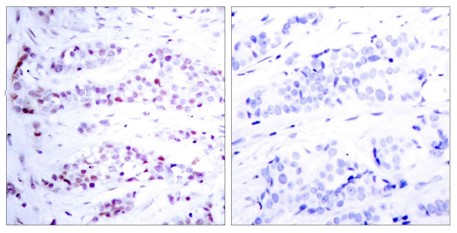STAT6 Antibody (p641)