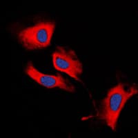 MMP13 Antibody (N-Terminus)
