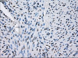 Monoclonal Mouse anti-Human SORD / Sorbitol Dehydrogenase Antibody (clone OTI9E7, IHC, IF, WB)