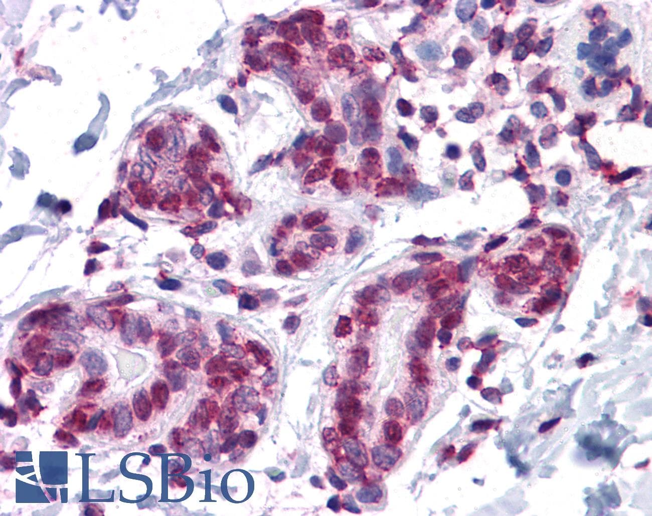 IHC-plus™ Monoclonal Mouse anti-Human GMEB1 Antibody (clone 2A8, IHC, IF, WB)