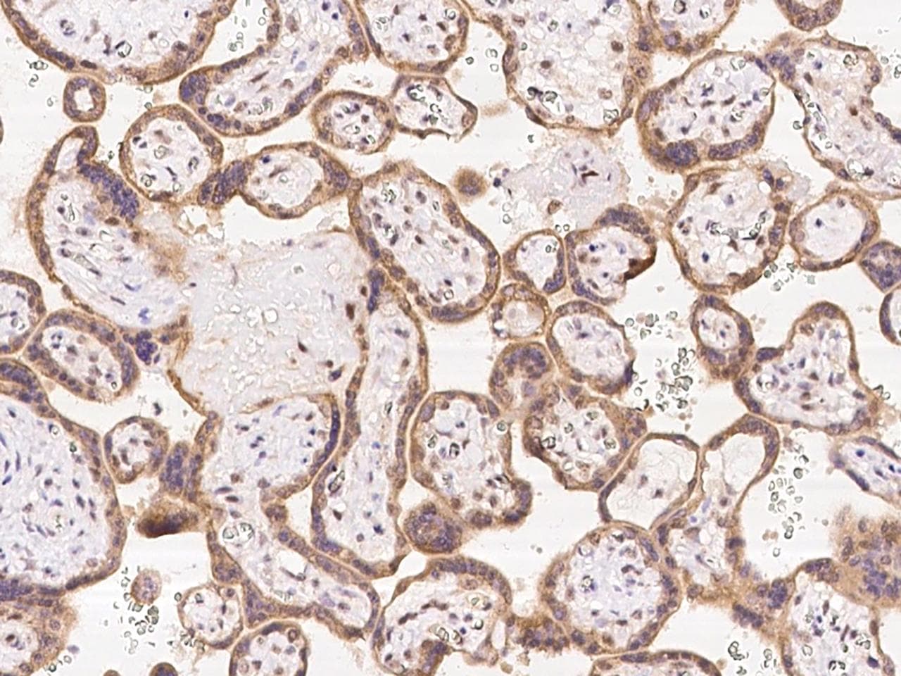 FAM206A / C9orf6 Antibody