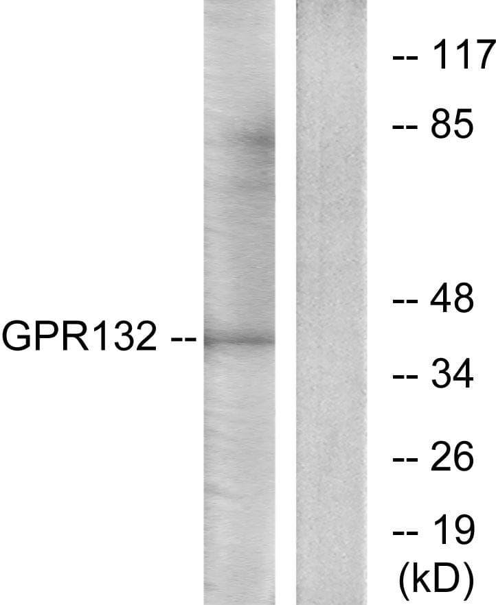 GPR132 / G2A Antibody