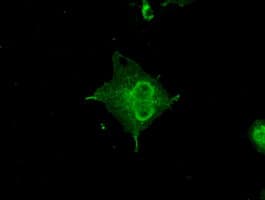 IHC-plus™ CRYAB / Alpha B Crystallin Antibody (clone 4A6)