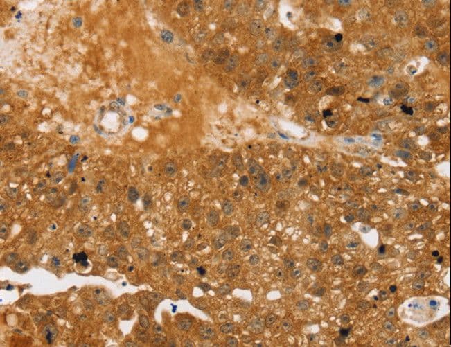 TBC1D4 / AS160 Antibody
