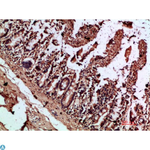 Polyclonal Rabbit anti-Human IL17C Antibody (IHC)