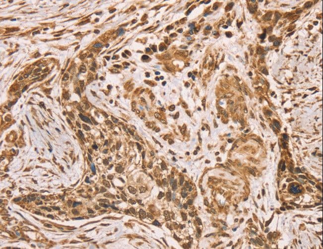 HIF1AN Antibody
