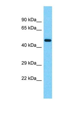 Polyclonal Rabbit anti-Human ZNF682 Antibody (aa108-157, WB)