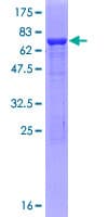 Human IDH1 / IDH Protein (Recombinant GST)