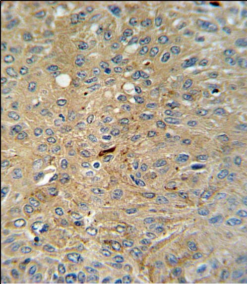 Polyclonal Rabbit anti-Human CASP3 / Caspase 3 Antibody (aa149-175, IHC)