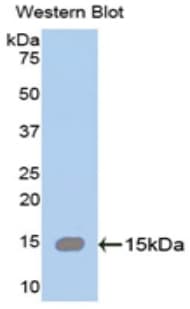 SPTAN1 / Alpha Fodrin Antibody (aa922-1043)