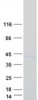 Human IMP4 Protein (Recombinant Myc-DDK (Flag))