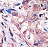 MAPK10 / JNK3 Antibody (aa1-30)