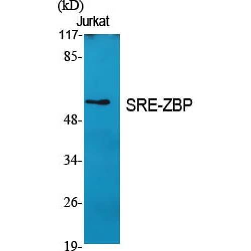 ZNF187 Antibody (30-110 aa, Internal)