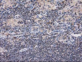 CAT / Catalase Antibody (clone OTI3C3)