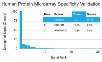 Monoclonal Mouse anti-Human Ubiquitin Antibody (clone UBB/2122, IHC)