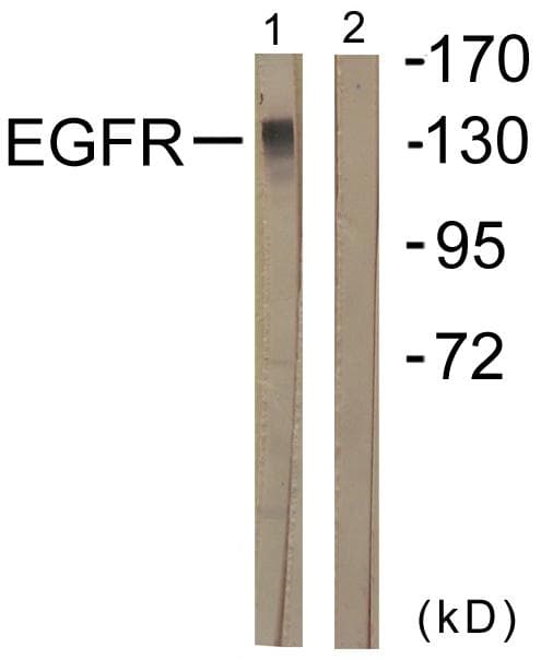 Polyclonal Rabbit anti-Human EGFR Antibody (p1016, IHC, IF, WB)
