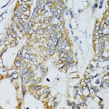 ECSIT Antibody