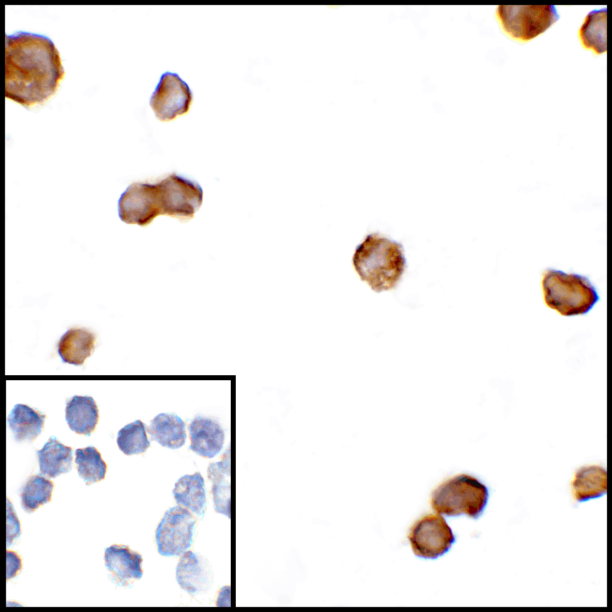 CTLA4 / CD152 Antibody (clone 1E6)
