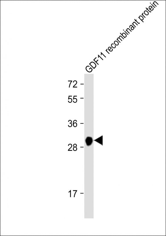 GDF11 / GDF-11 Antibody (clone 1956CT308.38.25)