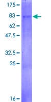 Human AGPAT6 Protein (Recombinant GST)
