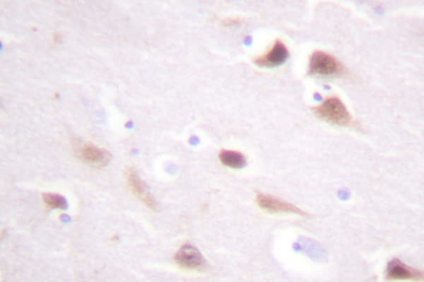 CSNK2B / Phosvitin Antibody (Ser205)