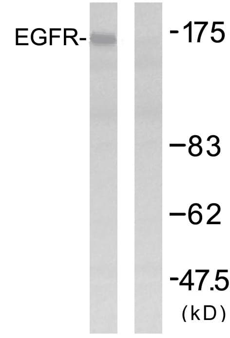 EGFR Antibody (aa1061-1110)