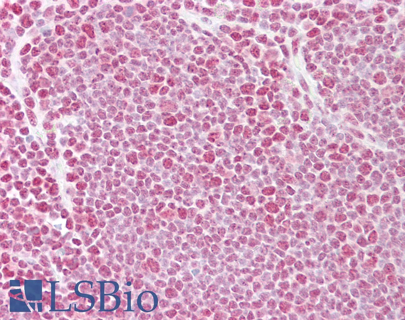 PathPlus™ Polyclonal Rabbit anti-Human TDP-43 / TARDBP Antibody (aa252-301, IHC, WB)
