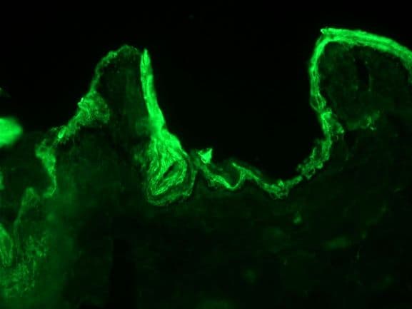PathPlus™ Monoclonal Mouse anti-Human KRT10 / CK10 / Cytokeratin 10 Antibody (clone DE-K10, IHC, WB)