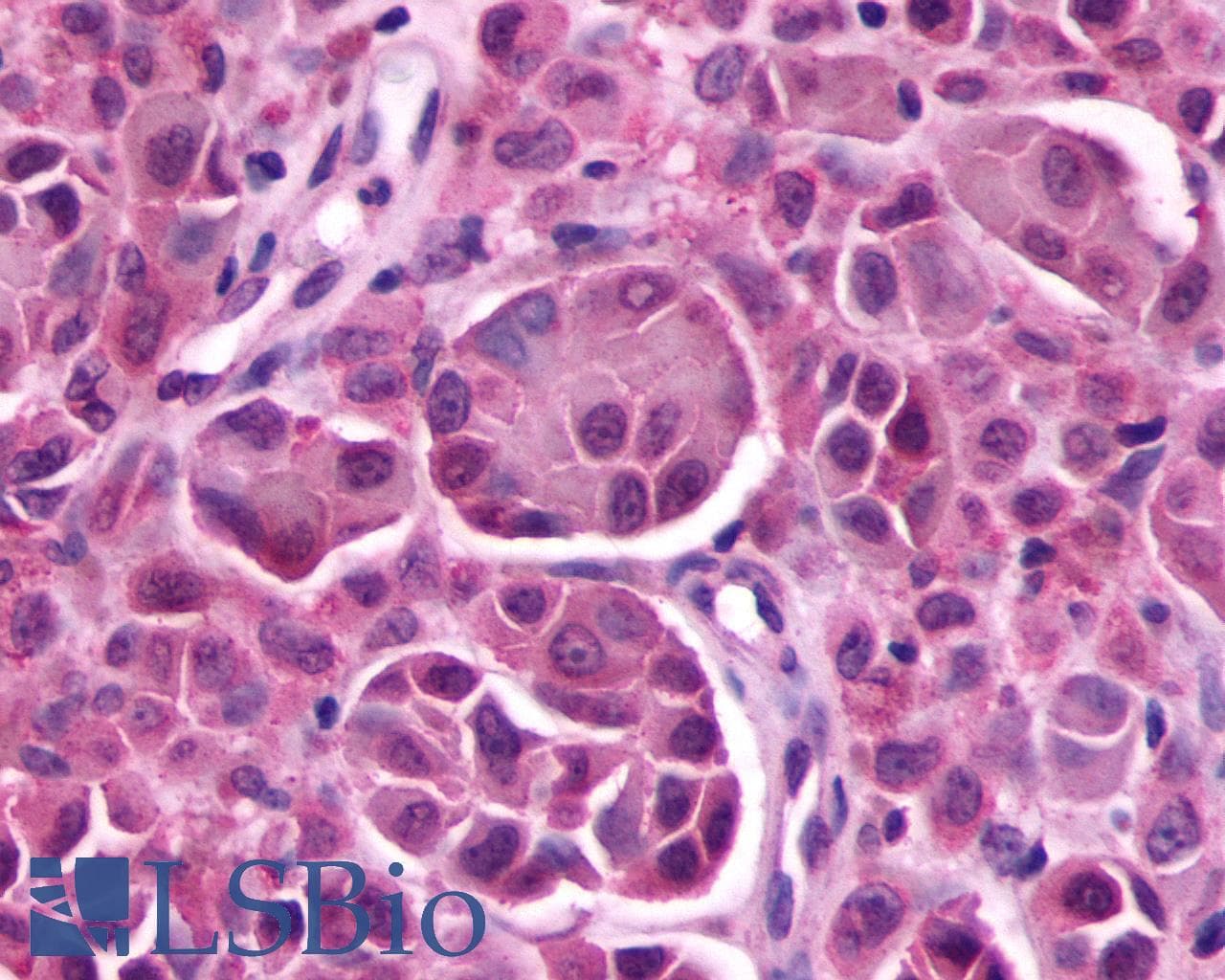 PathPlus™ PROKR2/Prokineticin Receptor 2 Antibody (C-Terminus)