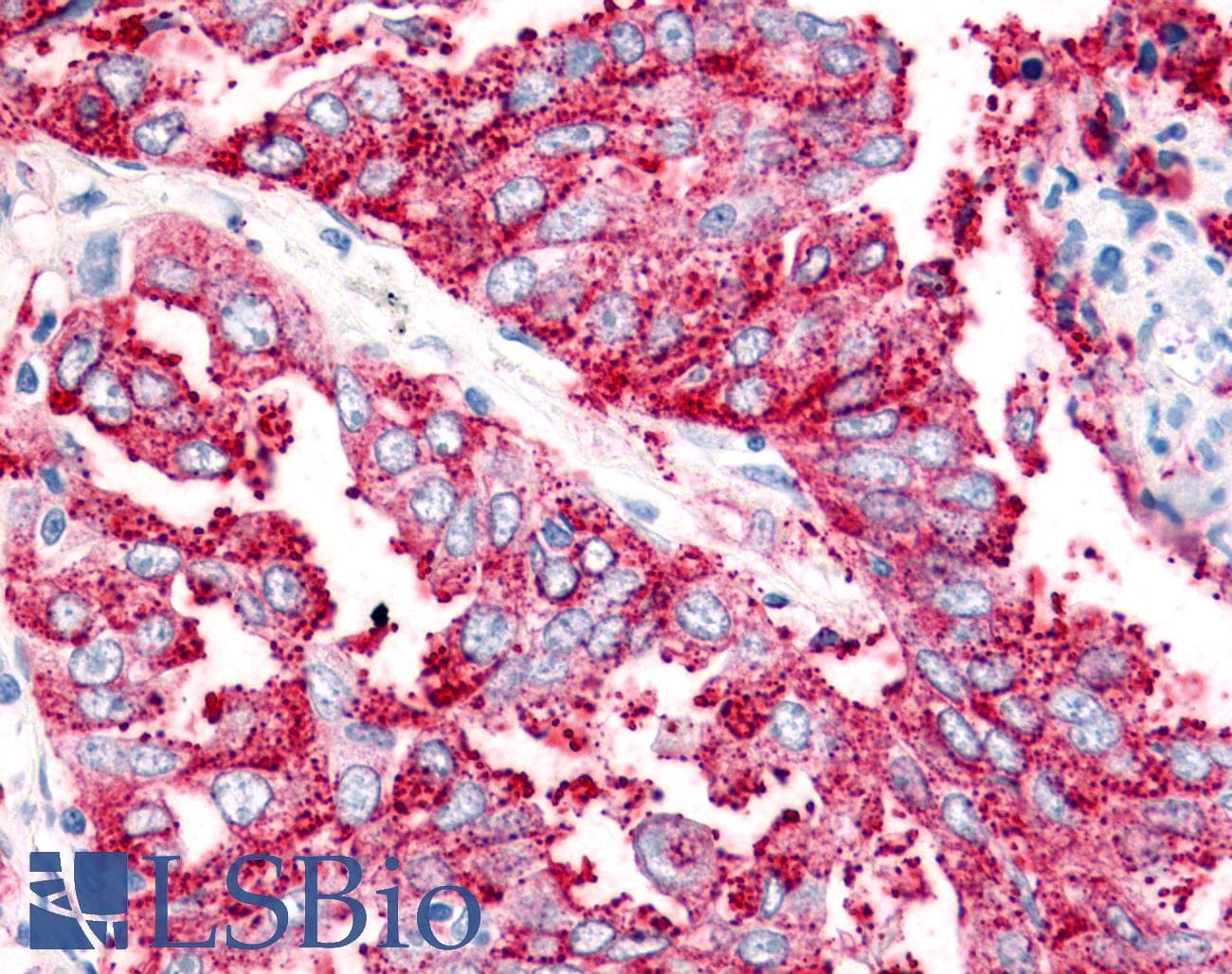 PathPlus™ VRL1 / TRPV2 Antibody (N-Terminus)