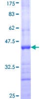 Human CHL1 Protein (Recombinant GST, N-terminus)