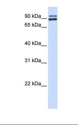PACE4 / PCSK6 Antibody (aa218-267)
