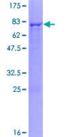 Human CYP2C18 / CYP2C Protein (Recombinant GST)