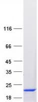 Human TBCA Protein (Recombinant Myc-DDK (Flag))