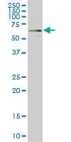 Monoclonal Mouse anti-Human YES1 / c-Yes Antibody (clone 2D5, WB)