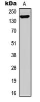 IHC-plus™ Treacle / TCOF1 Antibody (N-Terminus)