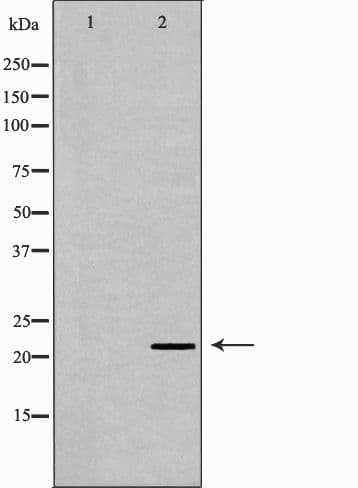 IFN Beta / Interferon Beta Antibody