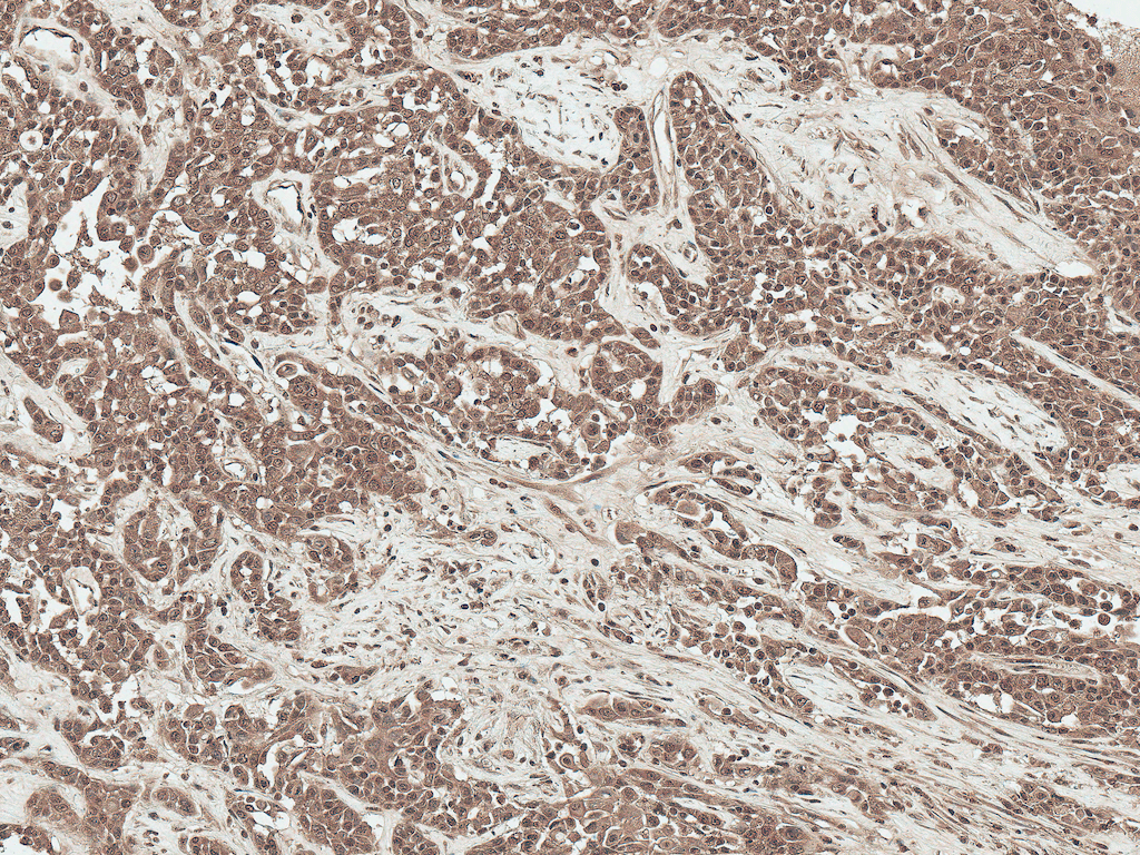 SFRP2 Antibody