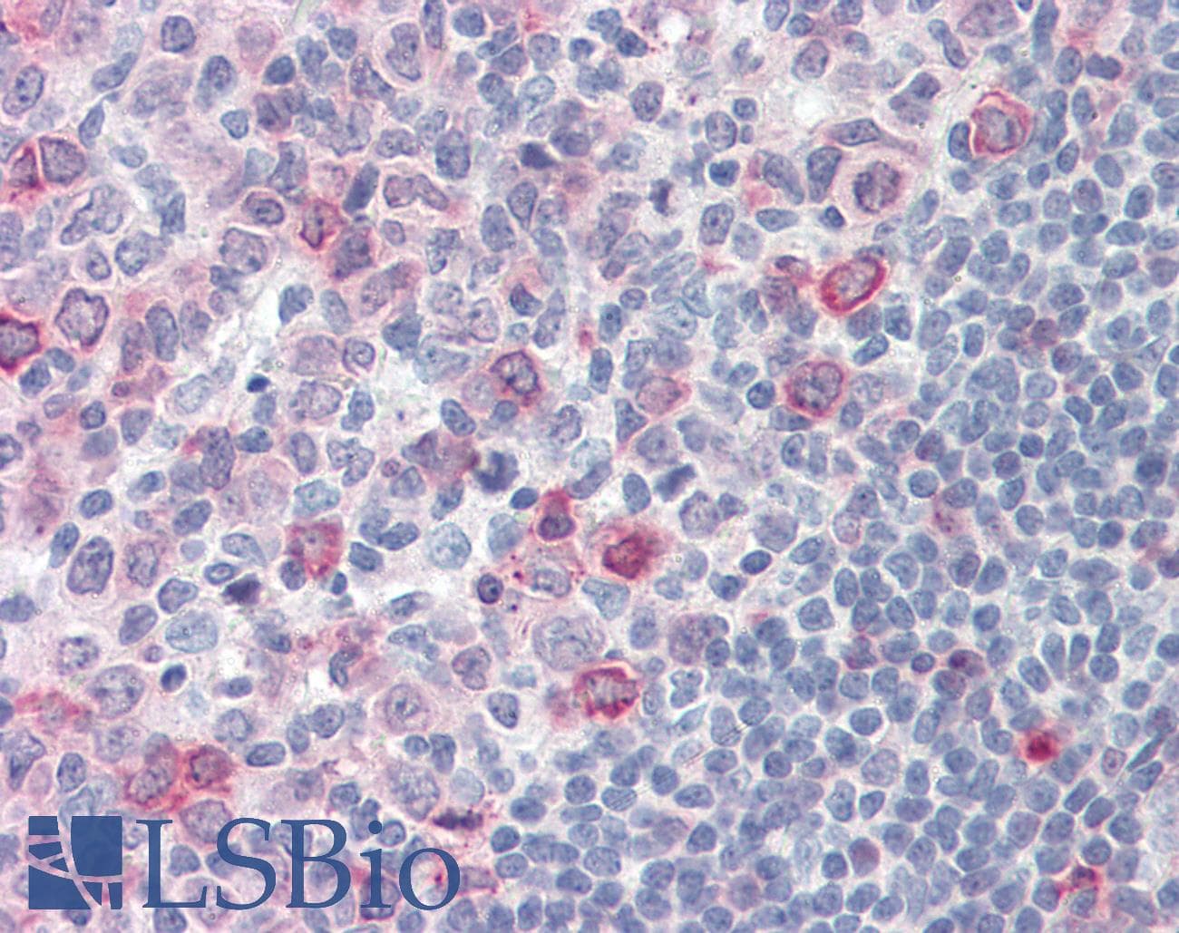IHC-plus™ SUSD2 Antibody (Internal)
